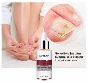 LANBENA Esencia de Reparación de Uñas