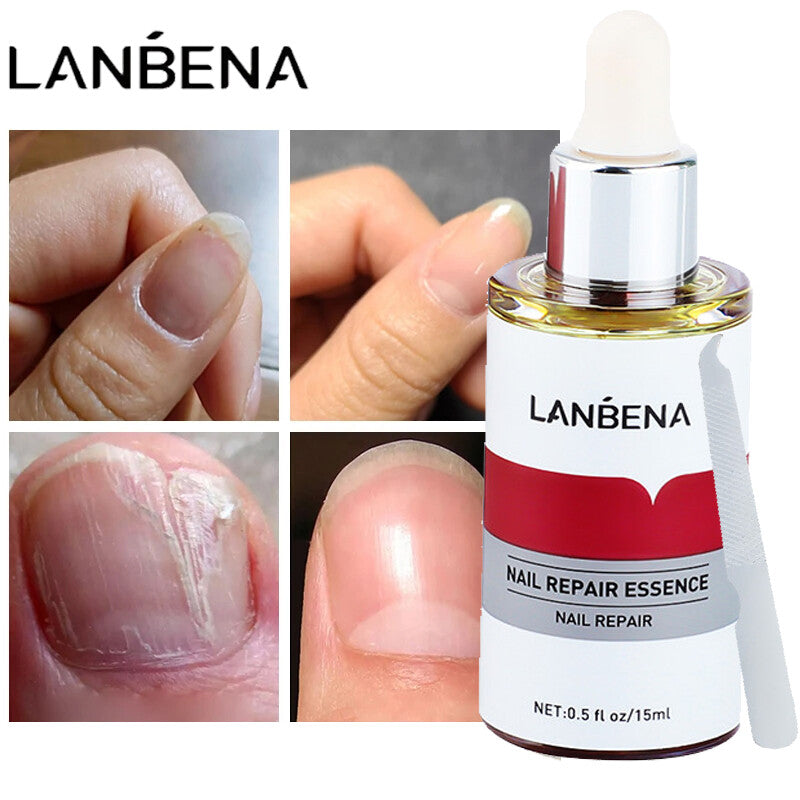 LANBENA Esencia de Reparación de Uñas