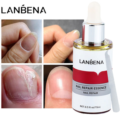 LANBENA Esencia de Reparación de Uñas