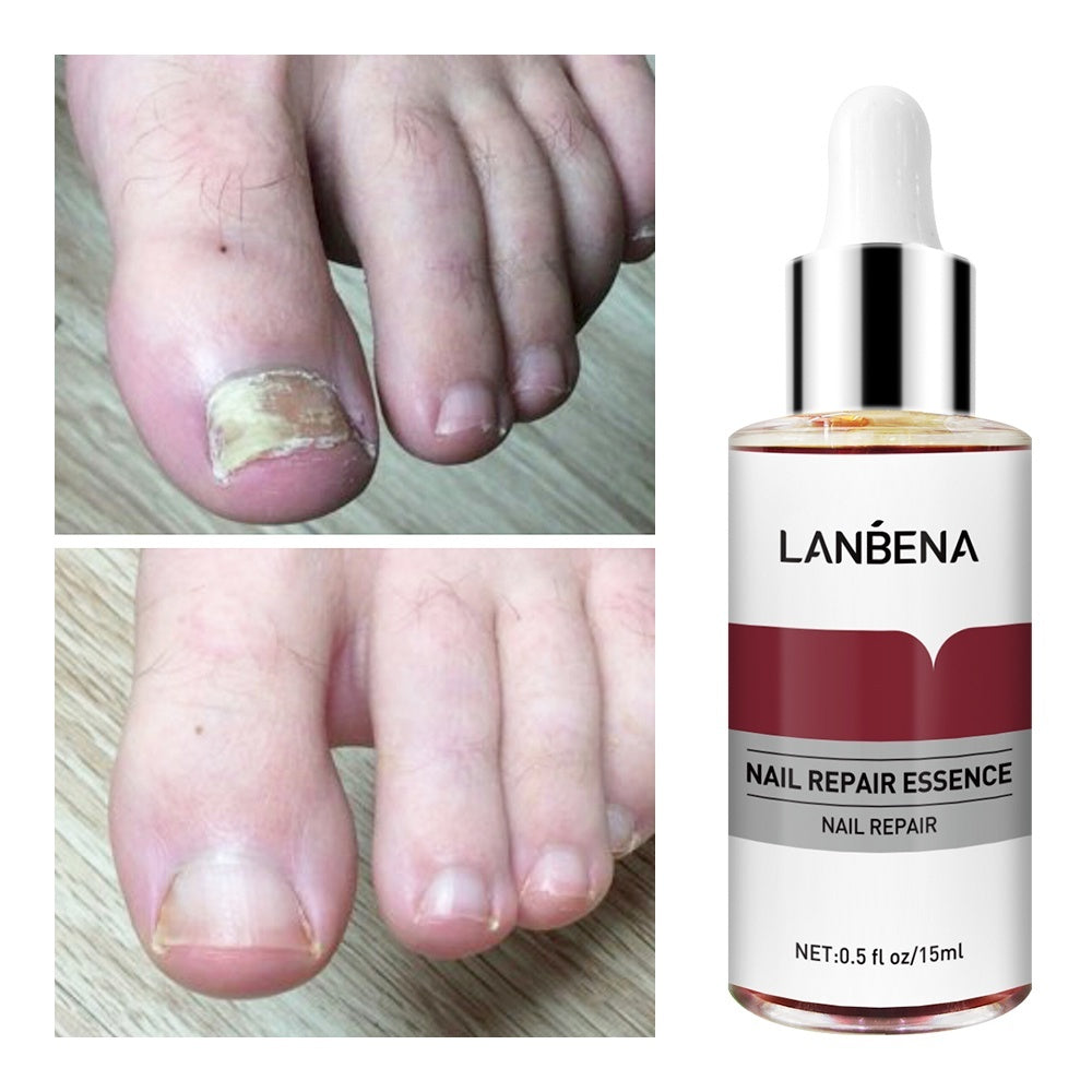 LANBENA Esencia de Reparación de Uñas